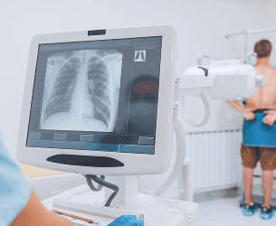 X-Ray