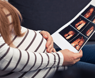 Ultrasound (4D)